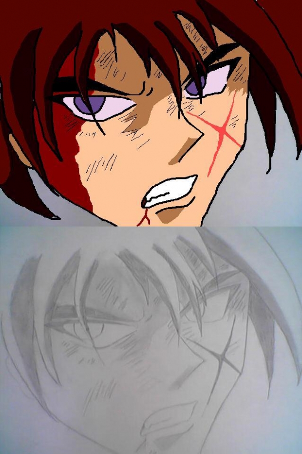 Kenshin Is Hurt