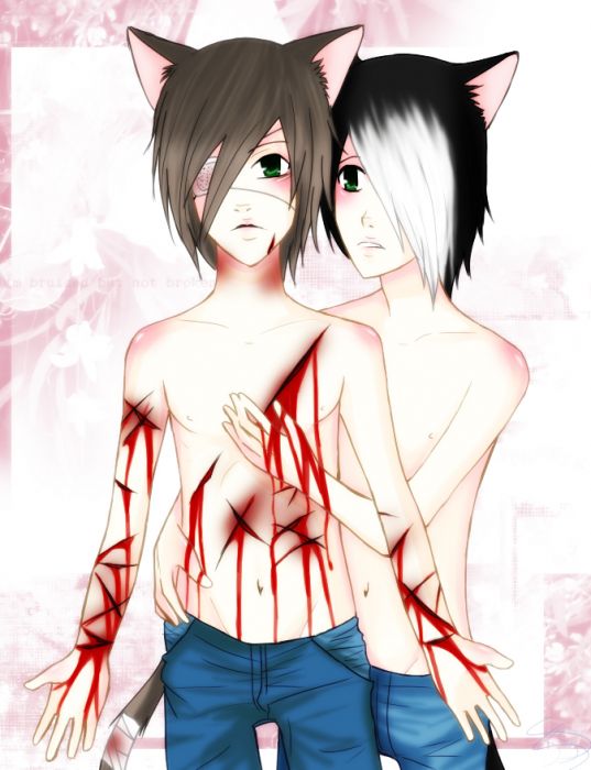 Bruised But Not Broken